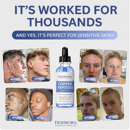 Dermora Copper Peptides Serum (GHKCU)