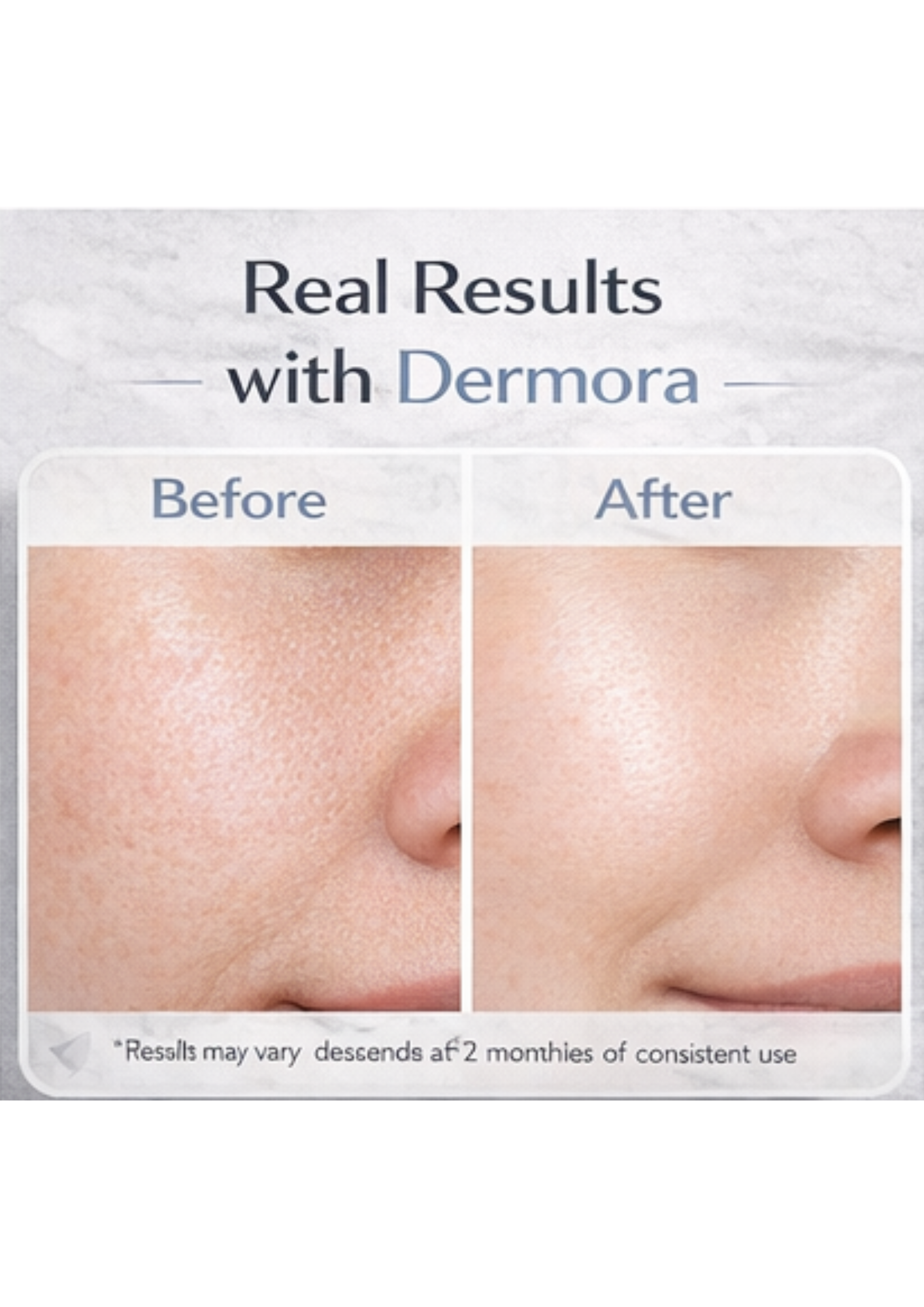 Dermora Copper Peptides Serum (GHKCU)